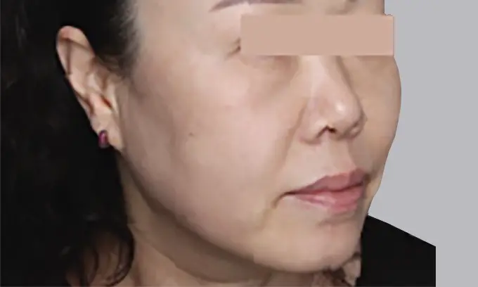 十倍電波使用前