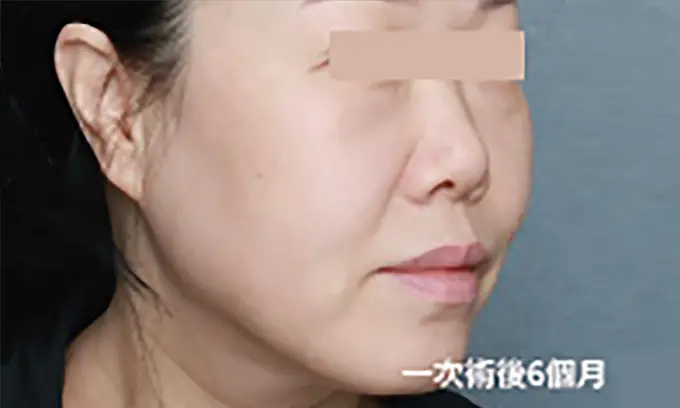 十倍電波使用後