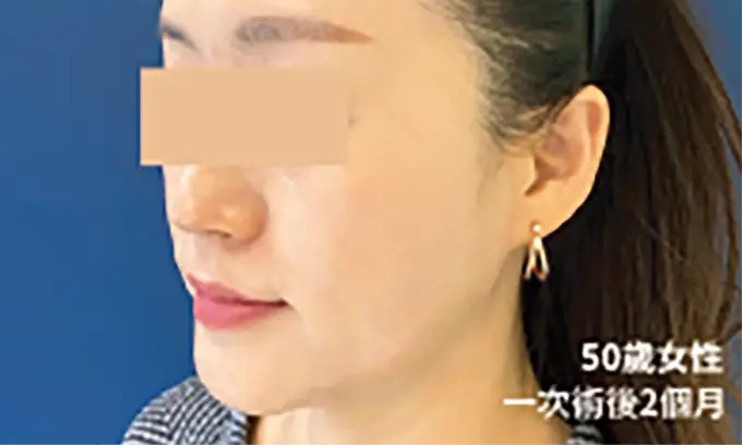 十倍電波
